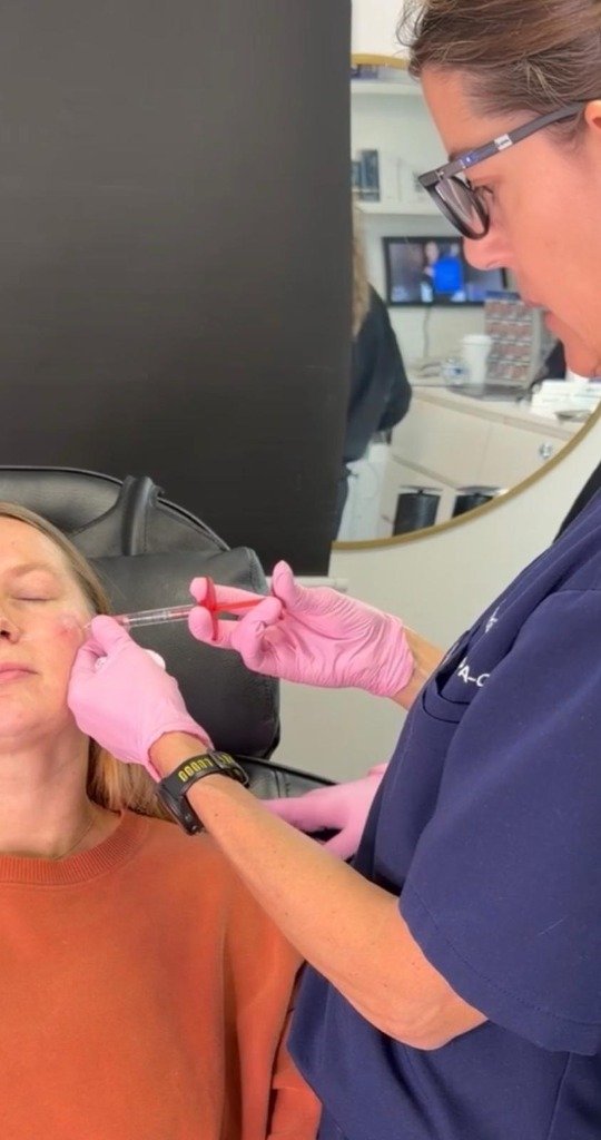 Dermal Fillers